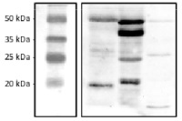 CGL78 | YCF54 in the group Antibodies Plant/Algal  / Photosynthesis  / GreenCut at Agrisera AB (Antibodies for research) (AS10 936)